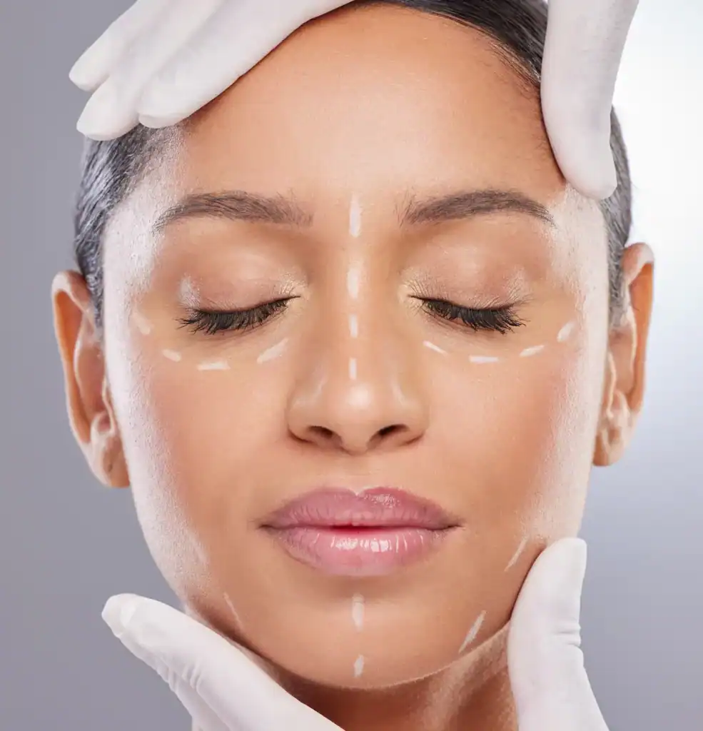 A woman with closed eyes has dotted white lines marked on her face, indicating cosmetic treatment areas, as she is gently touched by hands wearing white latex gloves—similar to a dentist’s careful approach.