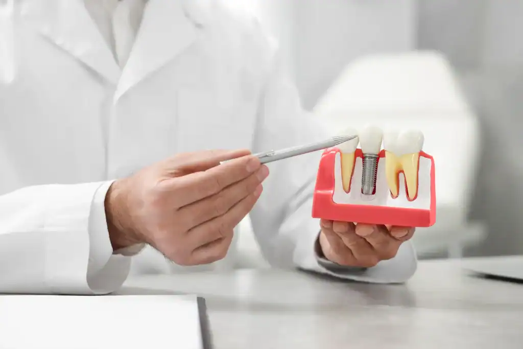 A dentist in a white lab coat holds a dental model showing teeth and an implant, using a pen to point at the implant, on a desk in a dental office.